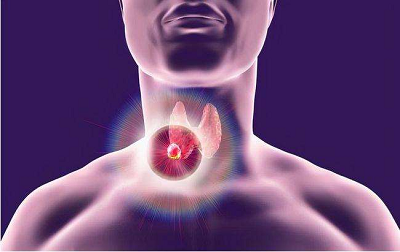 甲状腺结节是癌症的前兆吗？听听结节病医师罗登祥怎么说