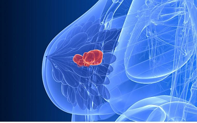 重庆有没有治疗乳腺结节好的中医馆?